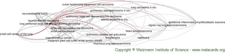 Diseases related to Lung Combined Large Cell Neuroendocrine Carcinoma