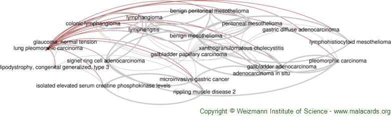 Diseases related to Lung Pleomorphic Carcinoma