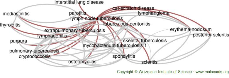 Diseases related to Lymph Node Tuberculosis