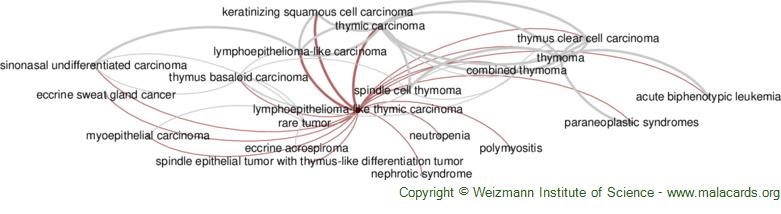 Diseases related to Lymphoepithelioma-Like Thymic Carcinoma