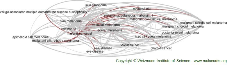 Diseases related to Melanoma, Uveal