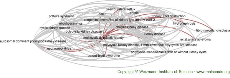 Diseases related to Multicystic Dysplastic Kidney