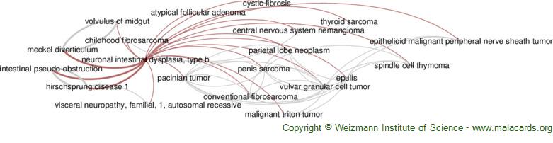 Diseases related to Neuronal Intestinal Dysplasia, Type B