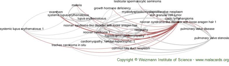 Diseases related to Noonan Syndrome-Like Disorder with Loose Anagen Hair 1