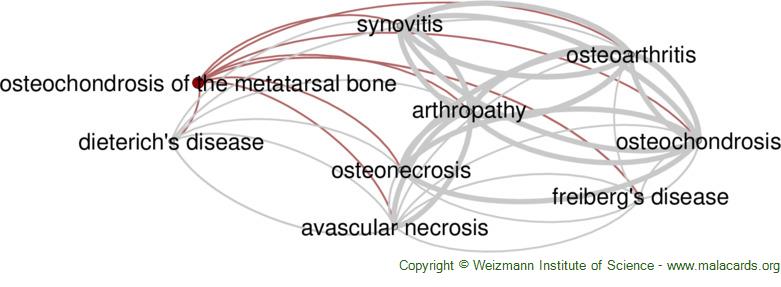 Diseases related to Osteochondrosis of the Metatarsal Bone