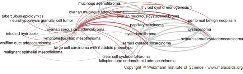 Diseases related to Ovarian Serous Cystadenofibroma