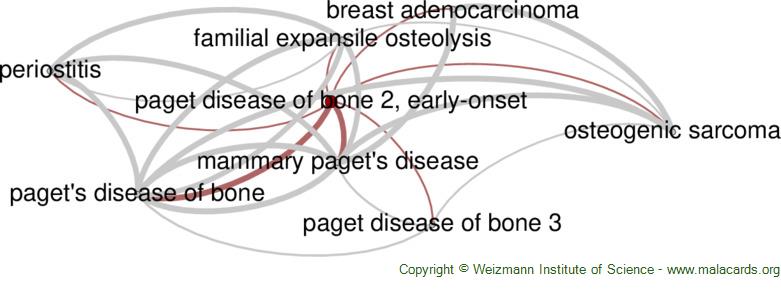 Diseases related to Paget Disease of Bone 2, Early-Onset