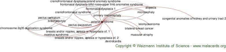 Diseases related to Poland Syndrome