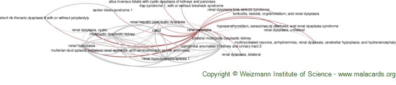 Diseases related to Renal Dysplasia