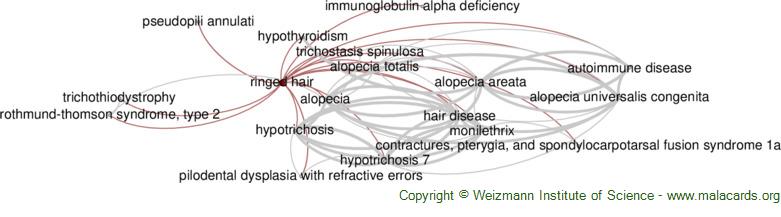 Diseases related to Ringed Hair