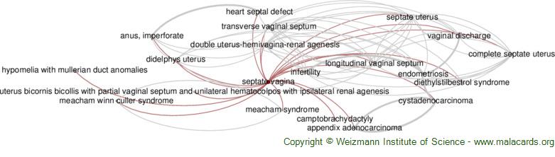 Diseases related to Septate Vagina