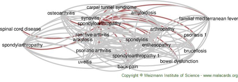 Diseases related to Spondyloarthropathy