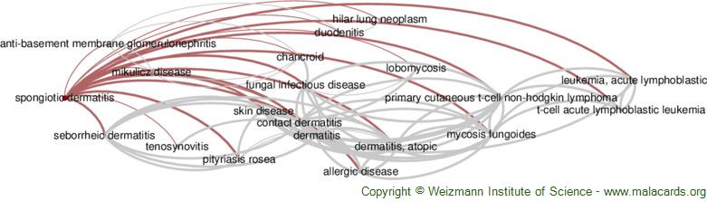 Diseases related to Spongiotic Dermatitis