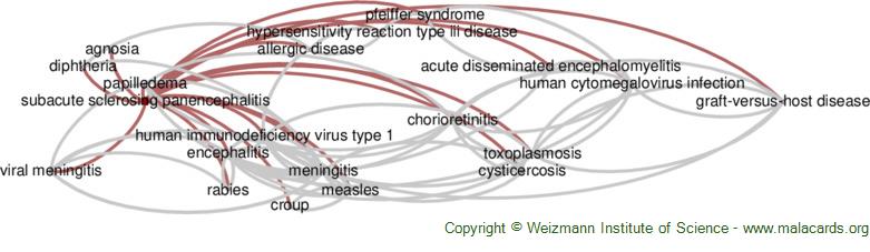 Diseases related to Subacute Sclerosing Panencephalitis