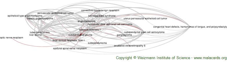 Diseases related to Subependymal Glioma