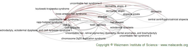 Diseases related to Uncombable Hair Syndrome 1