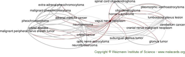 Diseases related to Vagus Nerve Neoplasm