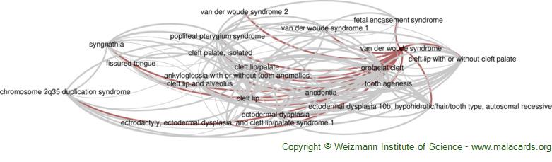 Diseases related to Van Der Woude Syndrome