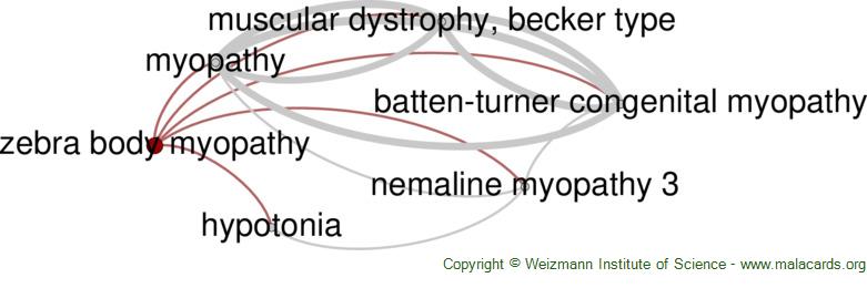 Diseases related to Zebra Body Myopathy